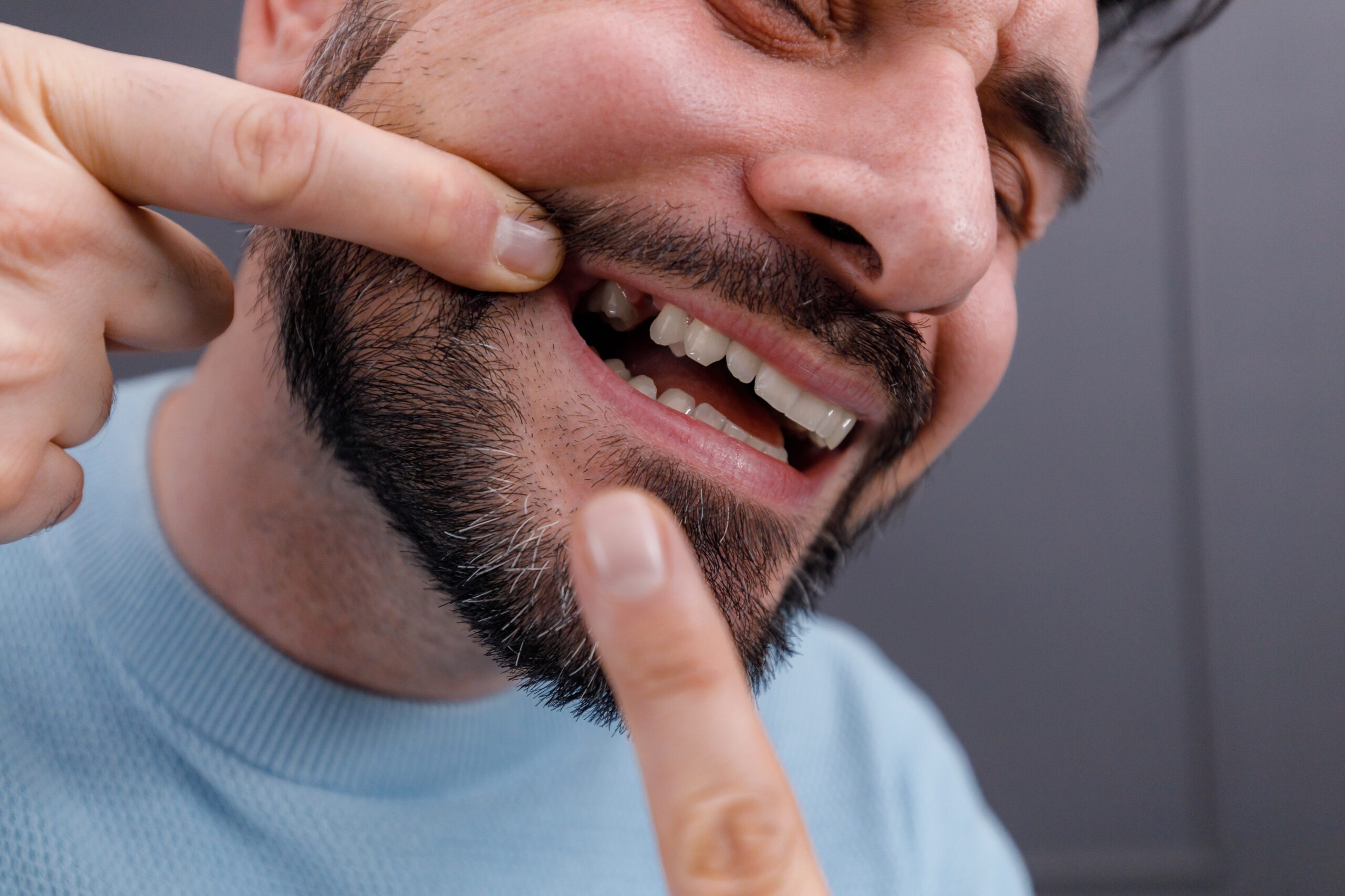 closeup of a man pointing to his missing tooth